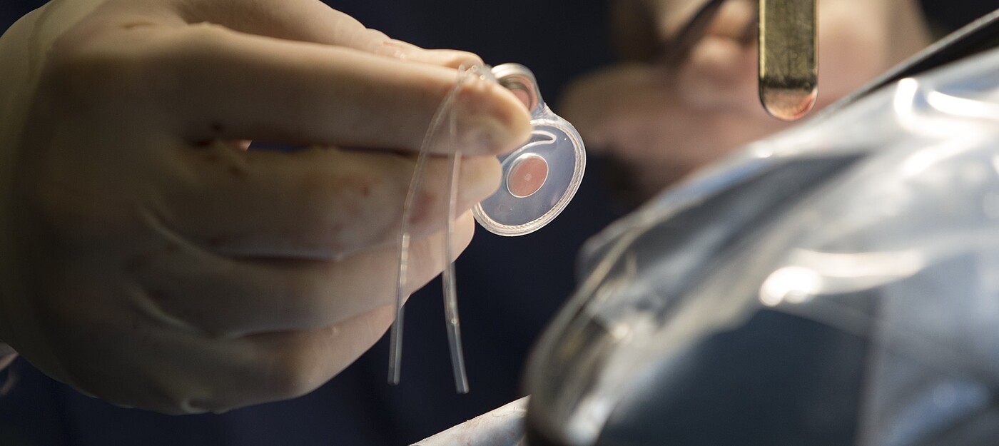 Using cochlear implants to preserve, restore hearing