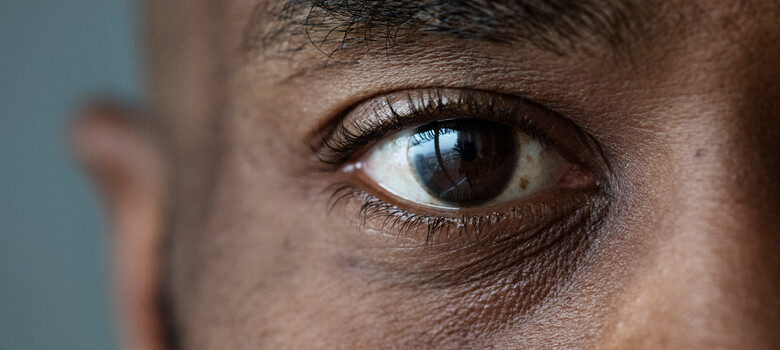 Seeing an Increase in Eye Floaters? See Your Eye Doctor