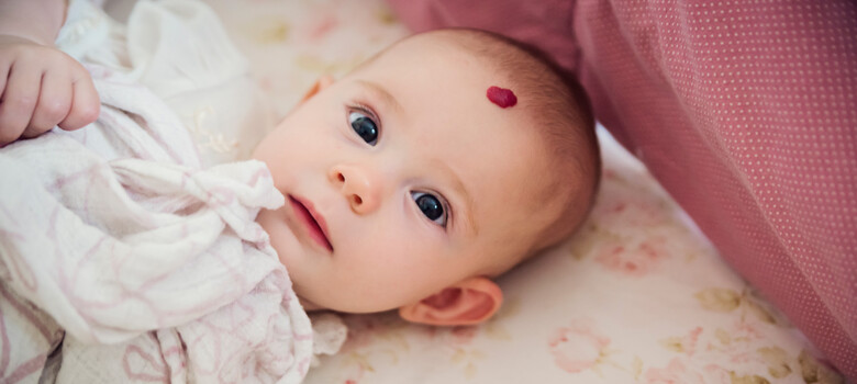 What Are Hemangiomas?