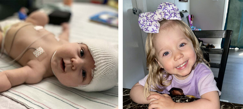 Epilepsy Surgery in Infancy Allows Toddler to Walk, Talk, and More