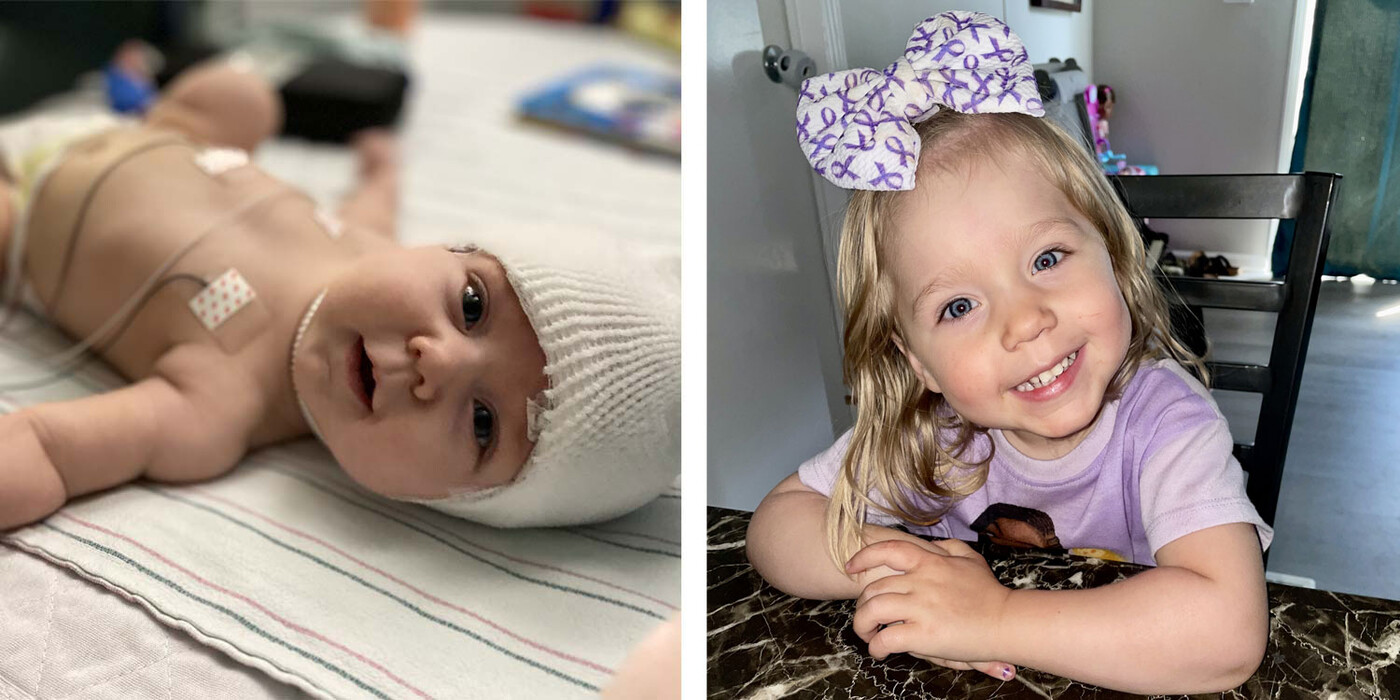 Left image, Lily in the hospital as a baby. Right image, Lily smiling while sitting at a table.