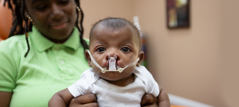 Nasoalveolar Molding Corrects Cleft Lip and Palate with Fewer Surgeries