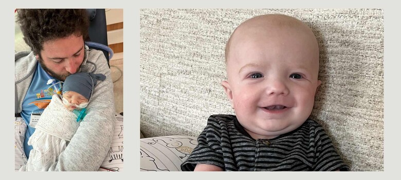 Duke Pediatric Heart Surgeons Perform World’s First Partial Heart Transplant 