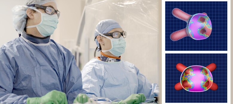 Duke Offering Pulsed Field Ablation to Treat Atrial Fibrillation 
