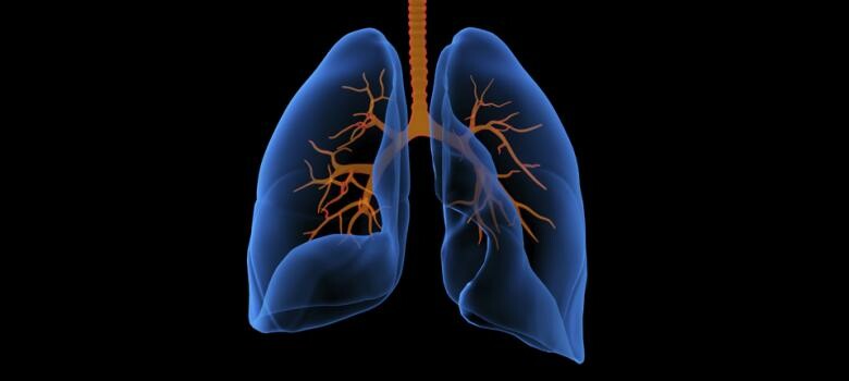 Diagnosing Lung Cancer May Get Easier for Some Patients