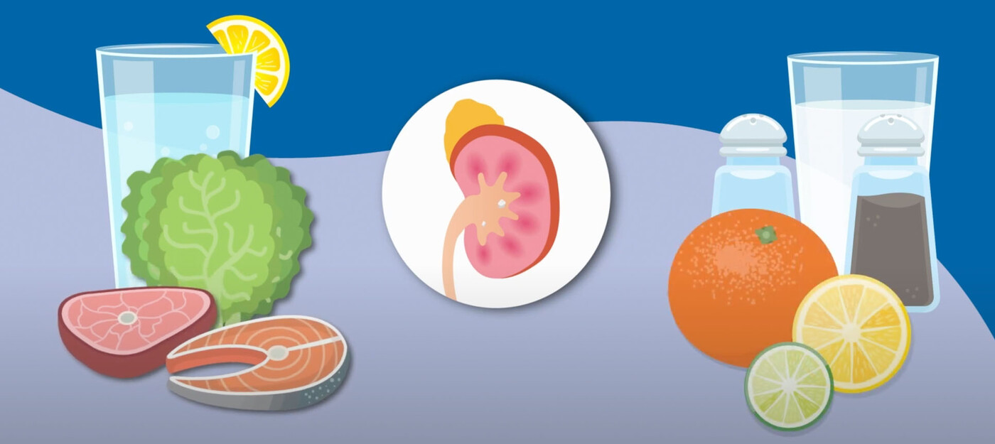 You can help prevent recurring kidney stones with dietary changes.