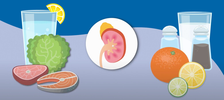 Learn to Prevent Recurring Kidney Stones